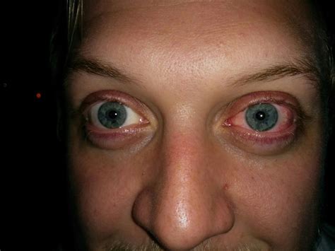 Look: Due to high .